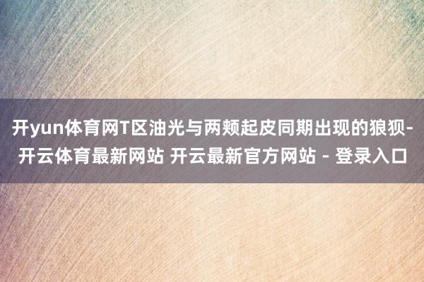 开yun体育网T区油光与两颊起皮同期出现的狼狈-开云体育最新网站 开云最新官方网站 - 登录入口